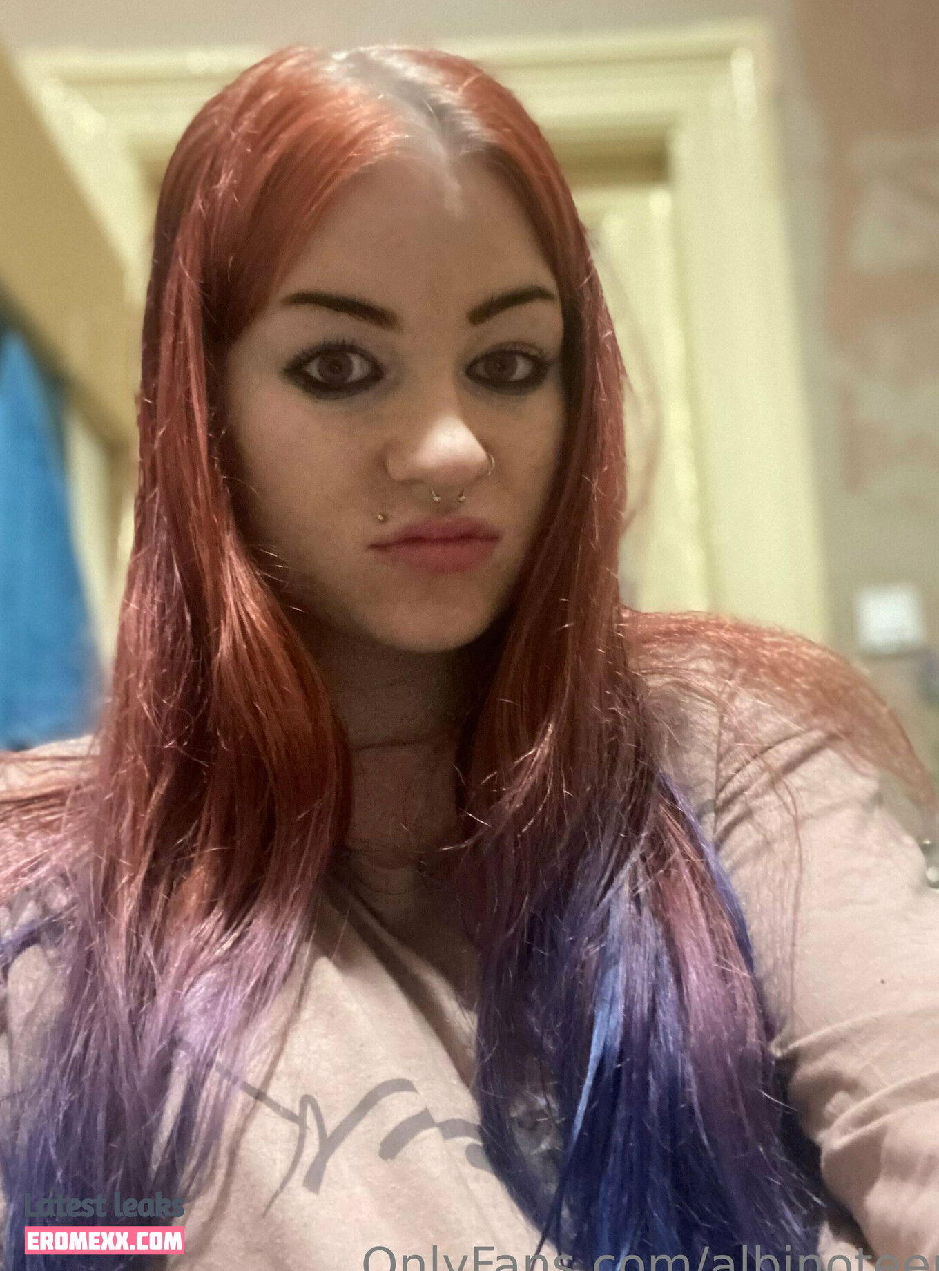 Latest Leaks albinoteen Nude #9 - Erome